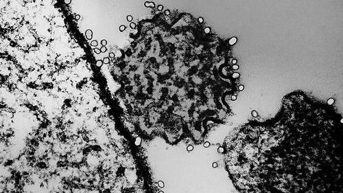 印度暴发致命尼帕病毒，尚无有效疫苗及疗法